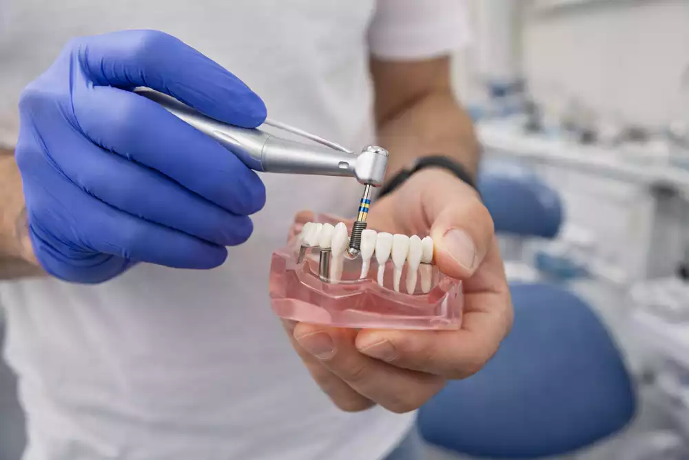 Нужен ли синус-лифтинг при имплантации зубов и в каких случаях он обязателен