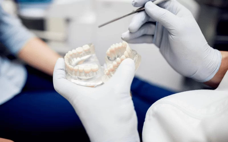 Микроимпланты в ортодонтии: что это и зачем?