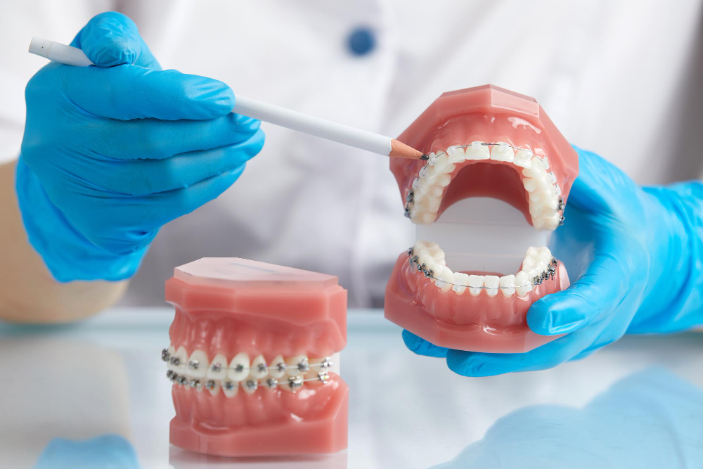 Глубокий прикус