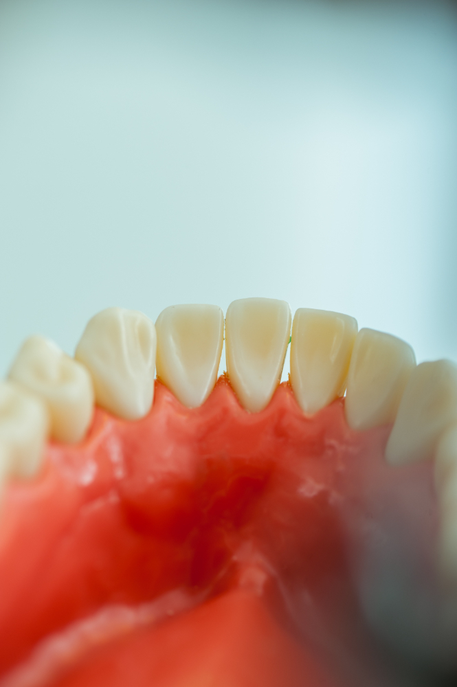 Гранулема зуба