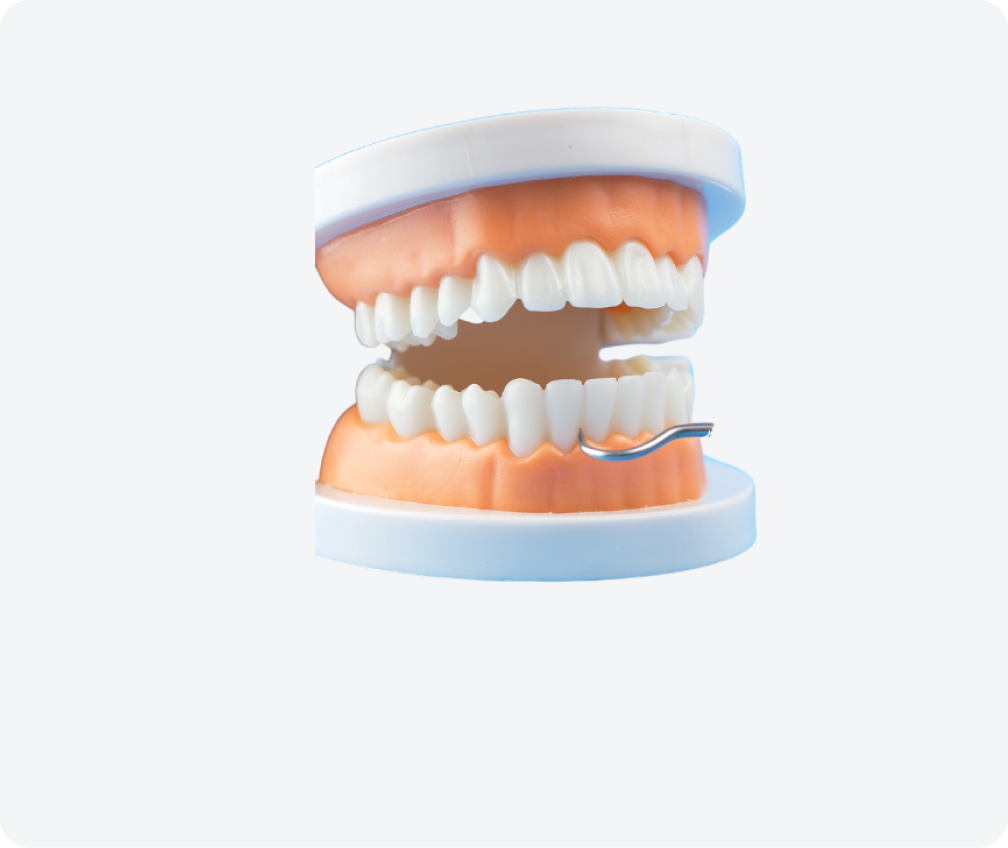 Шинирование зубов