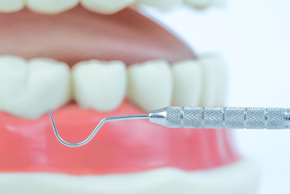 Флюс на десне