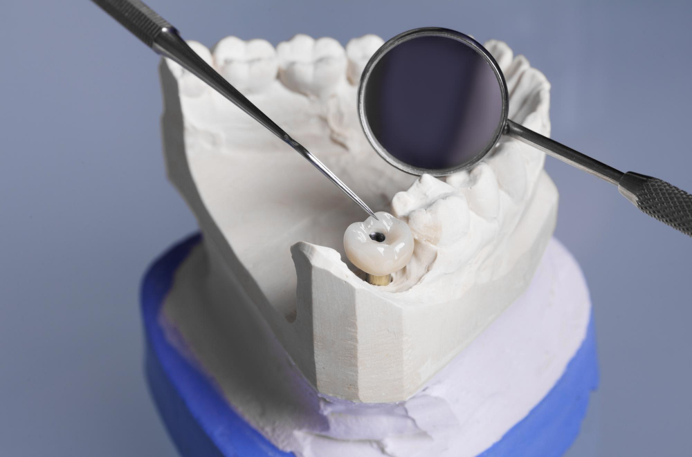 Какие витамины остановят кариес?