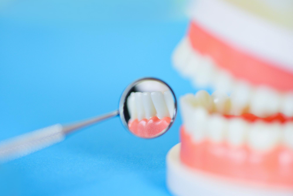 Виды современных пломб