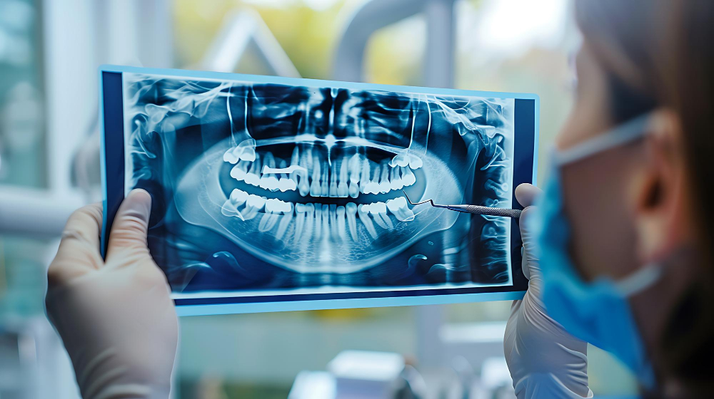 Хирургическое лечение остеомиелита челюсти