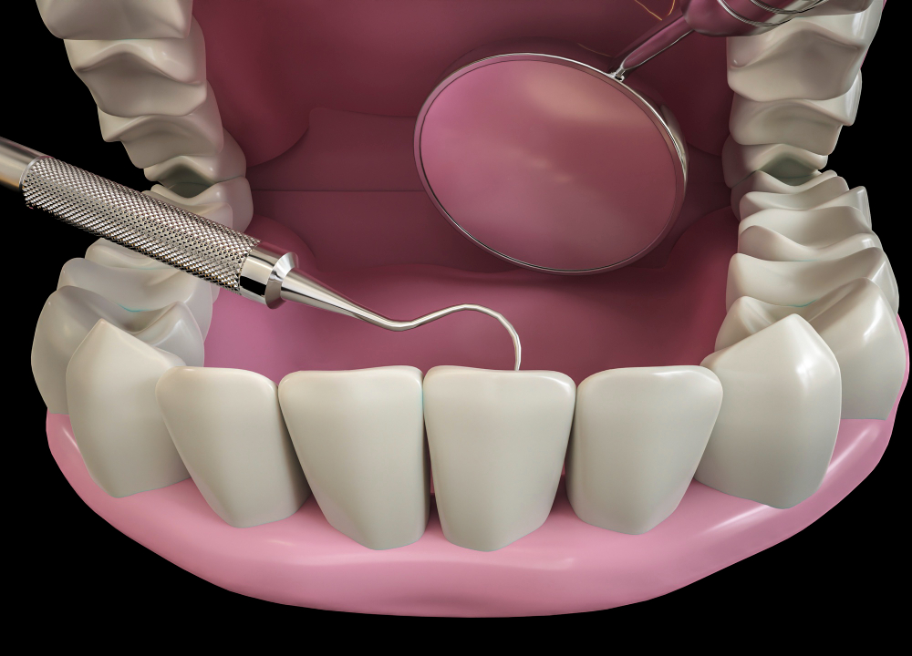 Шинирующие зубные протезы