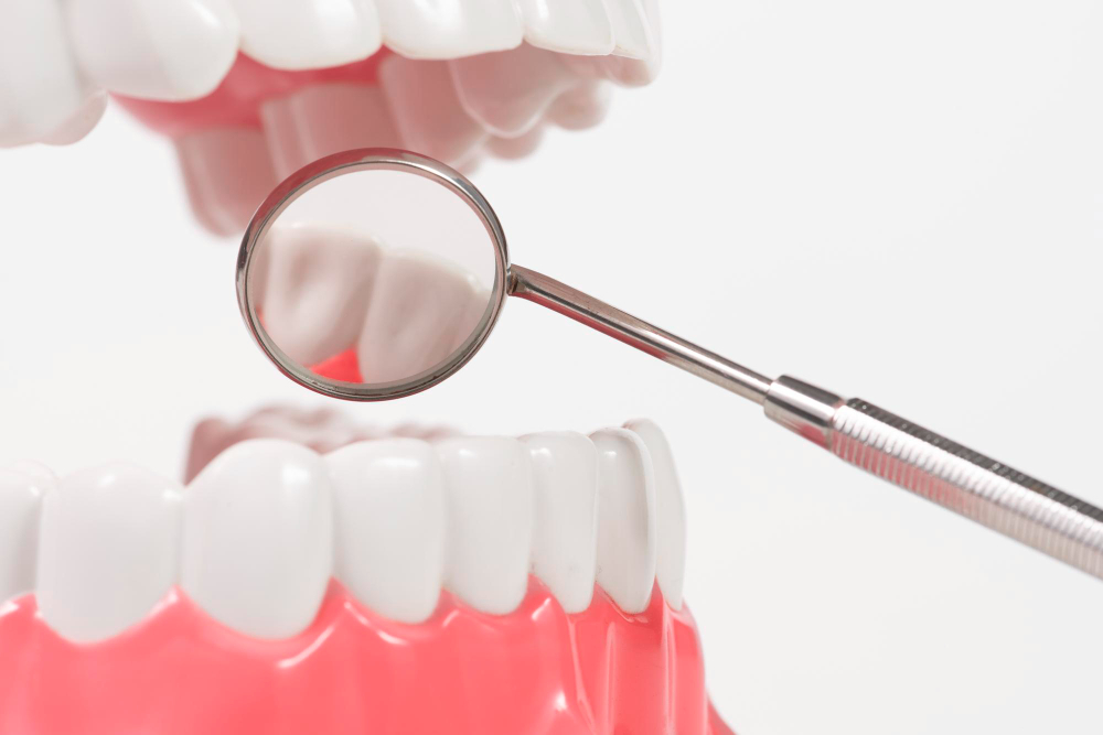 Виды современных пломб