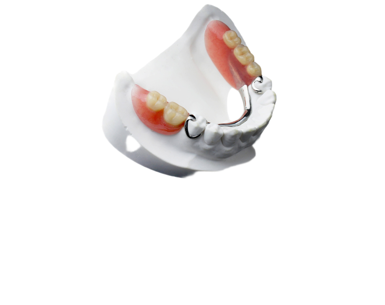 Бюгельные протезы