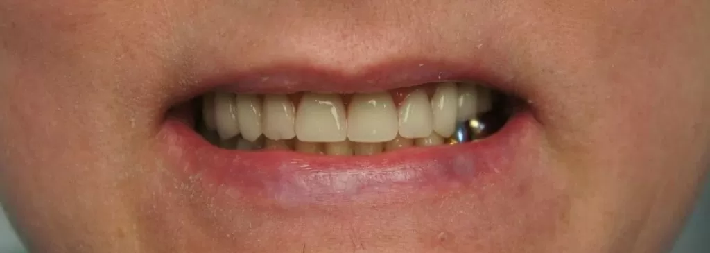 Из чего складывается стоимость