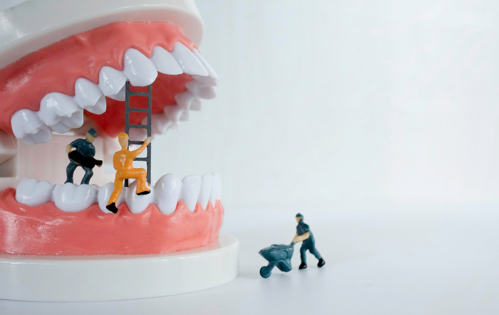 Как происходит установка коронки на имплантат