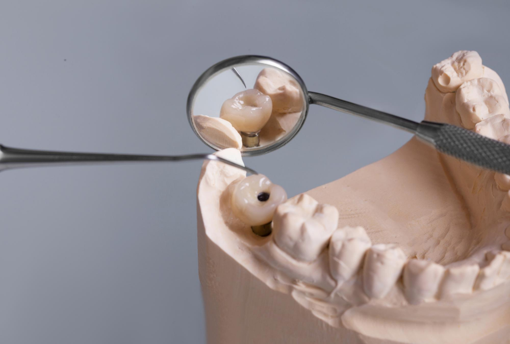 Лечение кариеса народными методами — миф или реальность