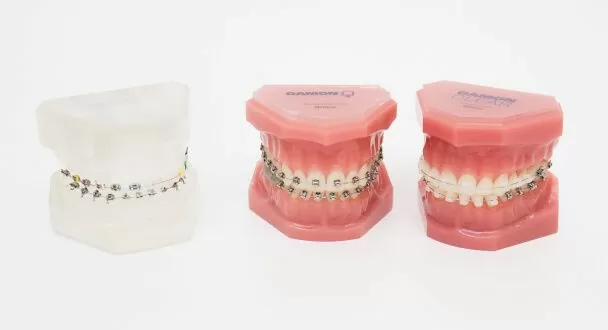 Установка брекетов