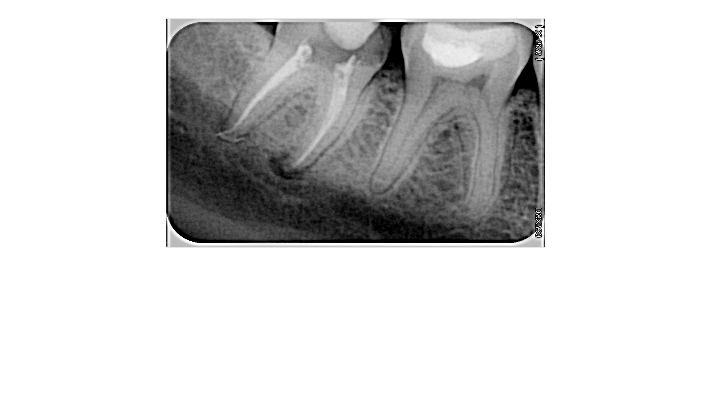 Прицельный снимок