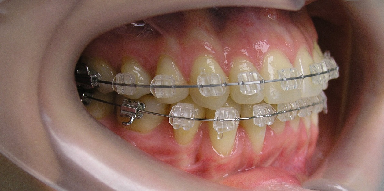 Из чего складывается стоимость