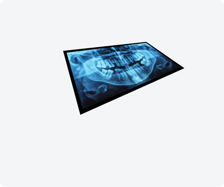 Рентген-снимок зубов