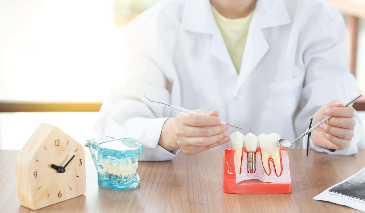 Протезирование или имплантация - что выбрать?