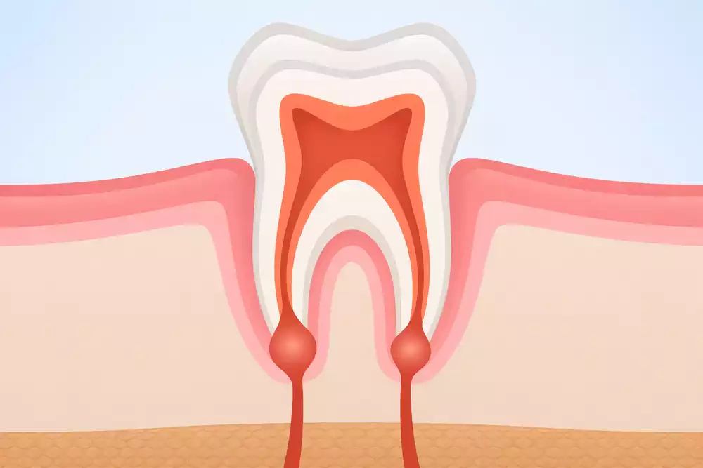 Воспаление корня зуба: симптомы и лечение