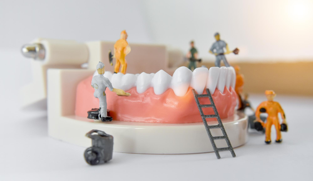 Как происходит установка коронки на имплантат