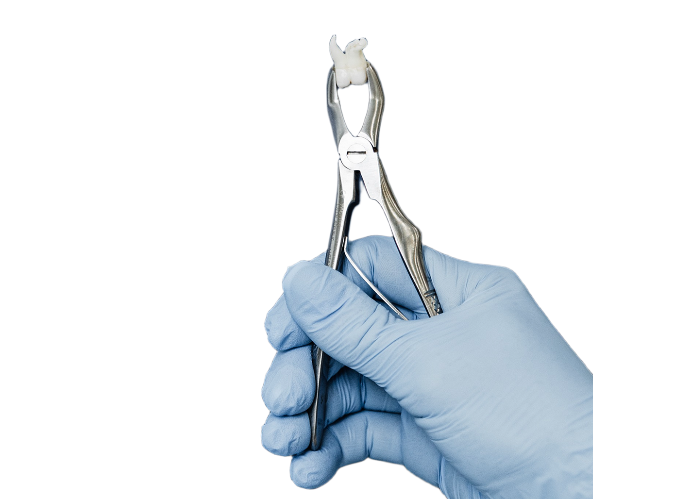 Удаление кисты зуба