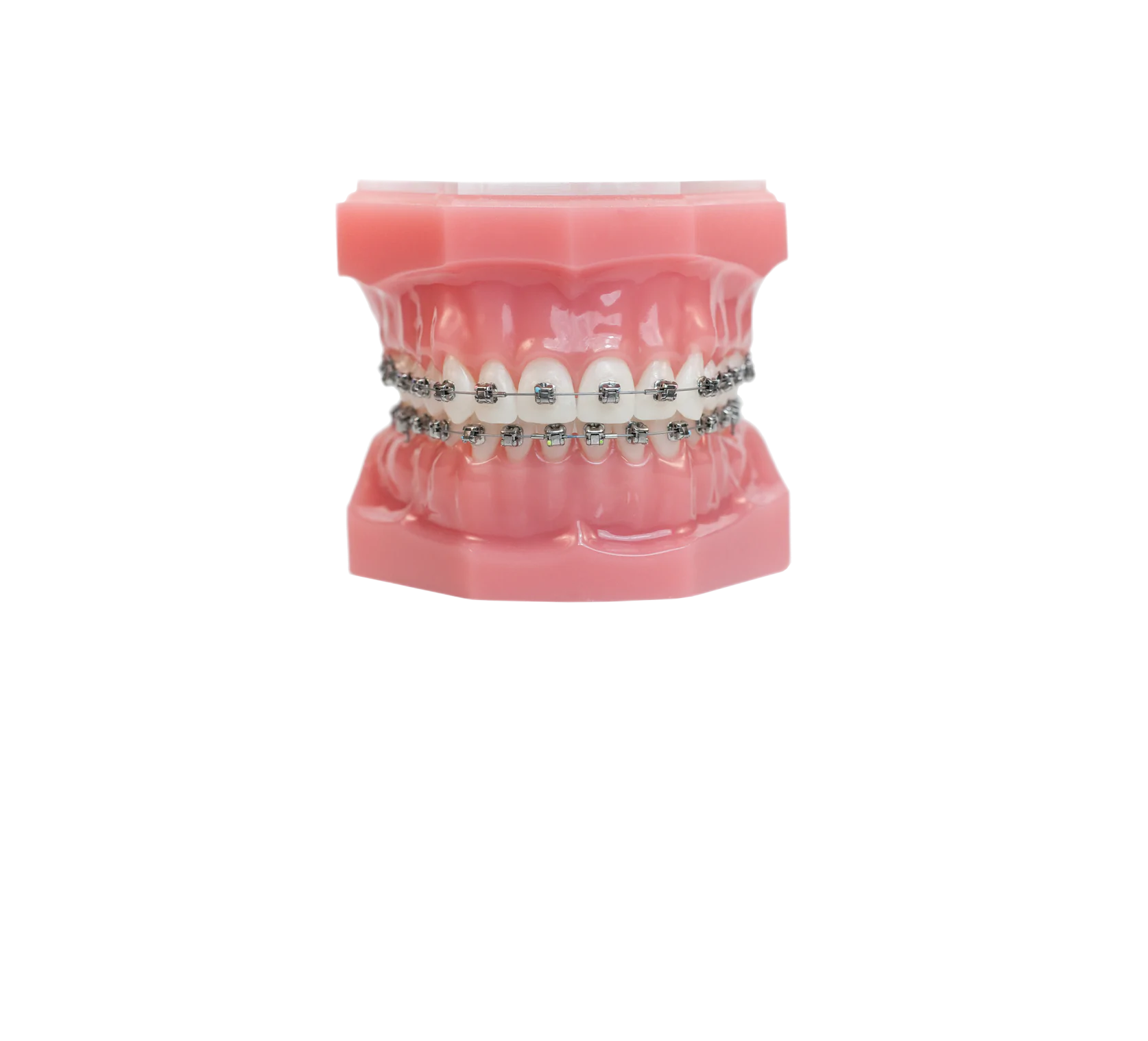 Брекеты Damon